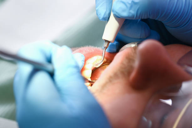 Best Emergency Dental Care for Abscessed Tooth in Cedar Falls, IA